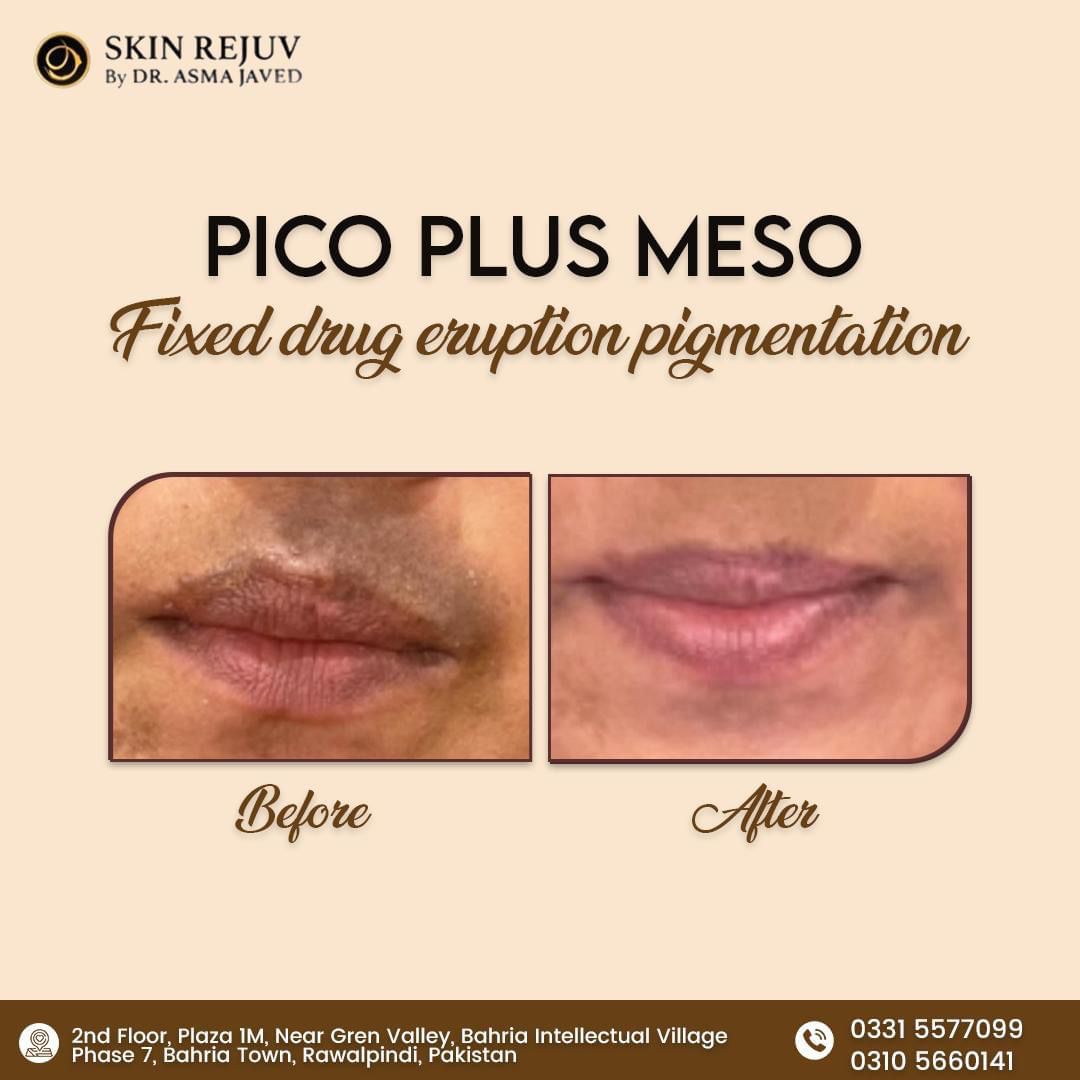 Before After Treatment 7